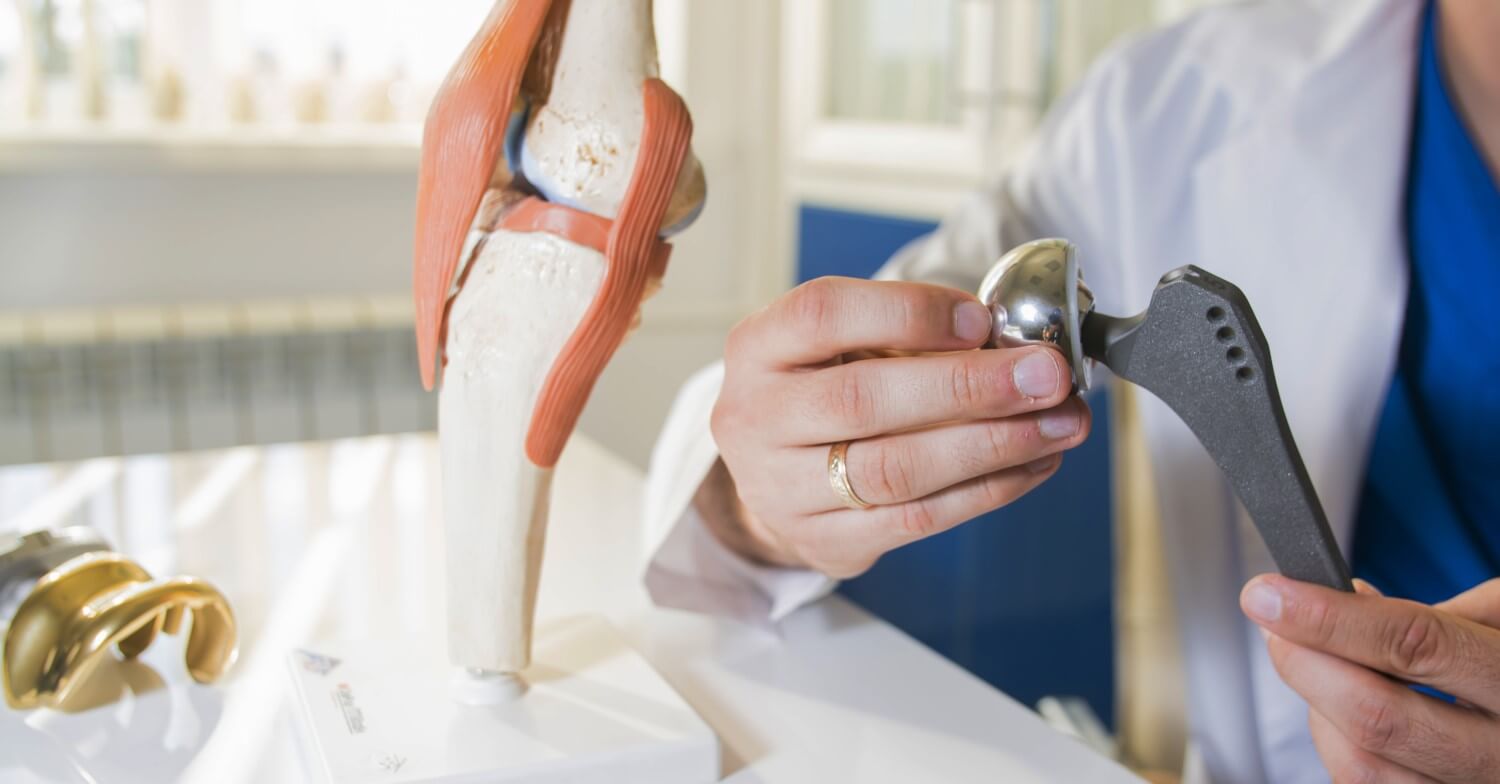 Ein Arzt hält ein künstliches Gelenk in Händen und hat vor sich ein Modell eines Hüftgelenks stehen